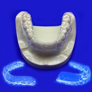 Invisible Retainer- Expedited (Lab mfg. in 3 business days)